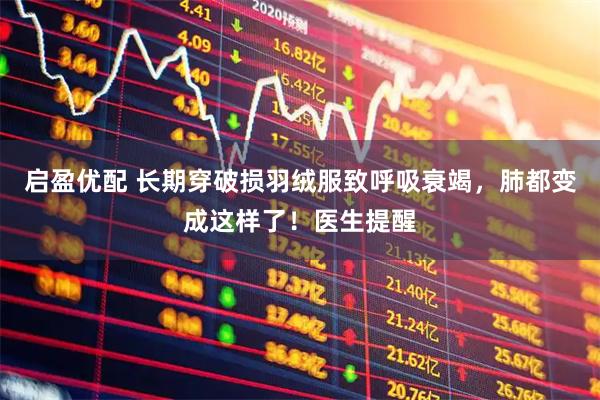 启盈优配 长期穿破损羽绒服致呼吸衰竭，肺都变成这样了！医生提醒